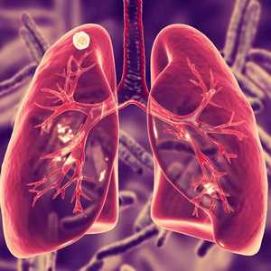 Избранные вопросы диагностики и лечения туберкулеза