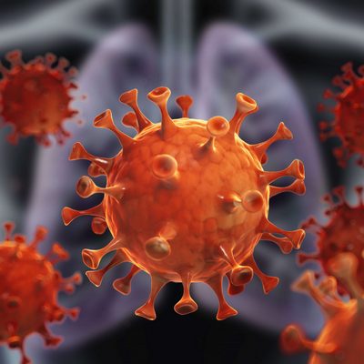 Актуальные вопросы новой коронавирусной инфекции (COVID-2019): клинико-эпидемиологическая характеристика, диагностика и лечение с вопросами инфекционной безопасности медицинского персонала